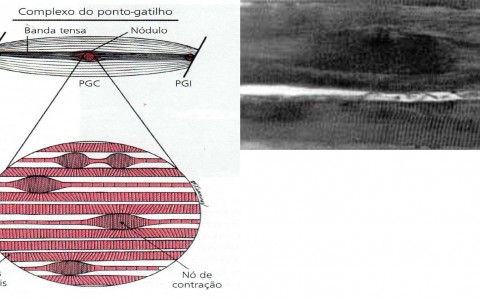 Ponto-Gatilho